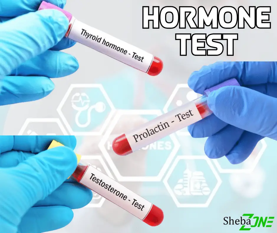 Hormone Test